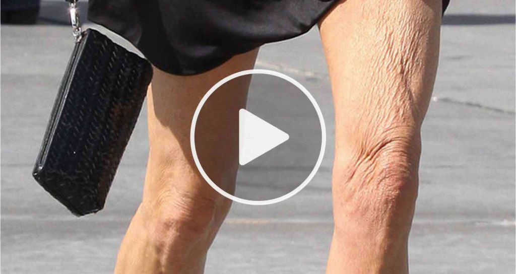 Skin Doctor Begs America: "Do This Every Morning To Lift Sagging Skin"