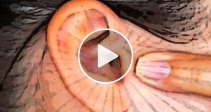 Silence Tinnitus By Doing This Immediately!