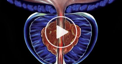 Men With ED Don't Know About This Simple Solution