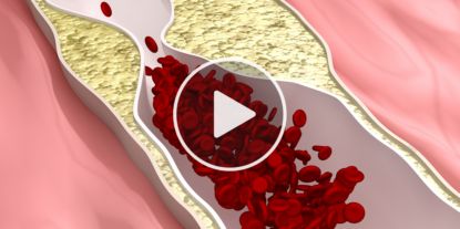 This "Clog" Is The Real Root Cause Of Prostate Problems — One Simple Trick To Fix