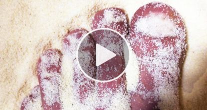 If You Have Toenail Fungus Try This Tonight (Genius)