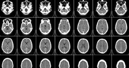 Just A Few Drops Of This "Miracle Medicine" Can Kill Cancer Fast