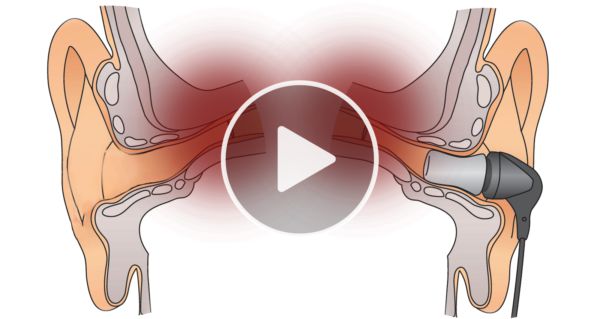 Brain Surgeon: Do This To Stop Your Tinnitus