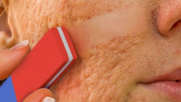 Do This Before Bed And Wrinkles Will Disappear In The Morning