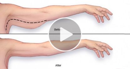 3 Easy Habits That Can Make Your Sagging Skin Snap Back