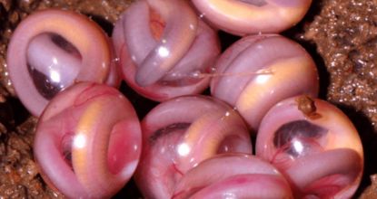 Metformin Will Kill Your Kidney (Do This To Stop It)