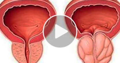 This "Clog" Is The Real Root Cause Of Prostate Problems — One Simple Trick To Fix