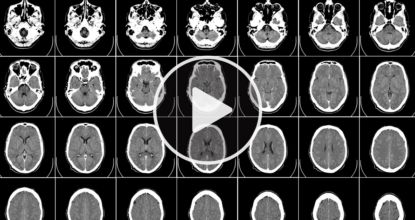 Just A Few Drops Of This "Miracle Medicine" Can Kill Cancer Fast