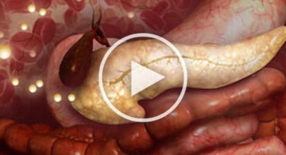 Stop Using Metformin. Here's Why