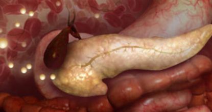 Stop Using Metformin. Here's Why