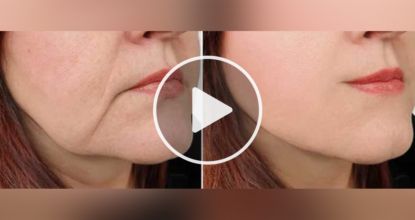 Household Items That Can Make Your Sagging Skin Snap Back