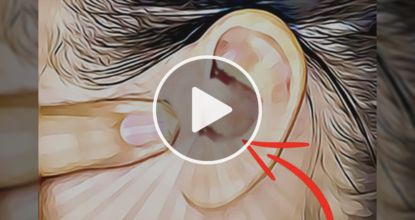 Brain Doctors Were Shocked When They Saw This (Stop Your Tinnitus)