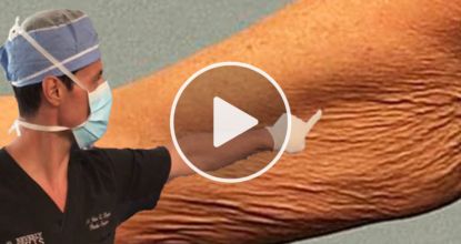 Easiest Morning Routine That Can Make Your Sagging Skin Snap Back